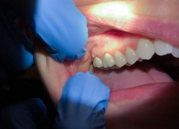 Best Broken Tooth Emergency  in Medina, MN